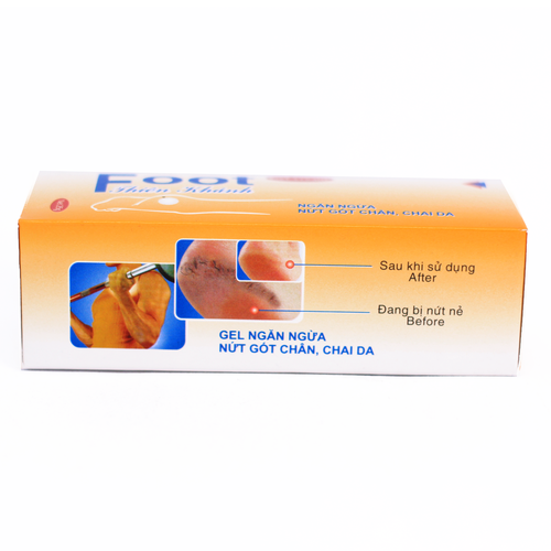 Footgel Thiên Khánh (T/25gr)