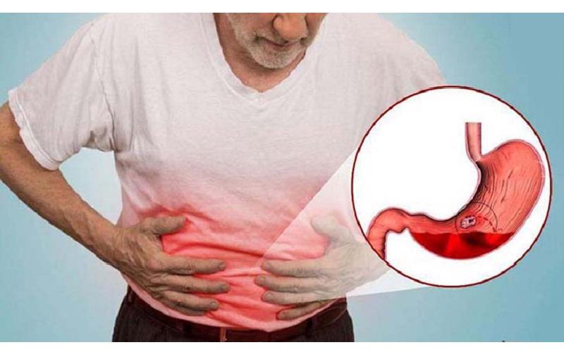 Những Thực Phẩm Tốt Cho Dạ Dày và thói quen giúp dạ dày khỏe mạnh 