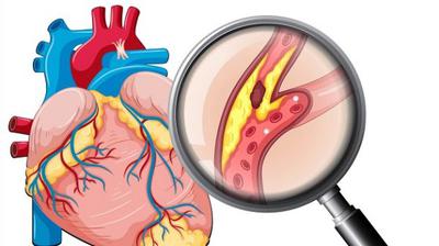 Đau Thắt Ngực Là Gì? Nguyên Nhân Và Những Bệnh Trạng Nguy Hiểm Cần Lưu Ý