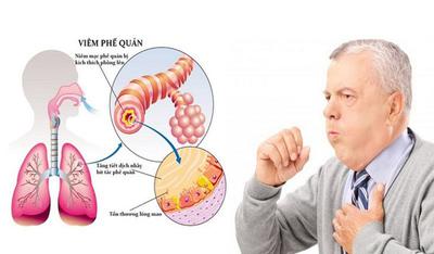 Viêm Phế Quản Nên Ăn Gì Và Kiêng Ăn Gì? Các Loại Thực Phẩm Cần Tránh Khi Bị Viêm Phế Quản